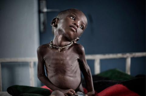 В Нигерии ежедневно от голода будут умирать 134 ребенка